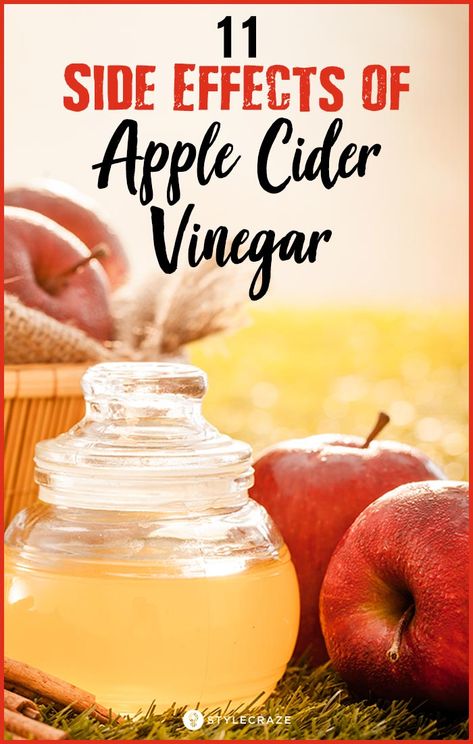 Acv Benefits, Apple Cider Vinegar Remedies, Cider Vinegar Benefits, Vinegar Benefits, Apple Cider Vinegar Benefits, Apple Cider Vinegar Drink, Apple Vinegar, Cold Sores Remedies, Natural Sleep Remedies