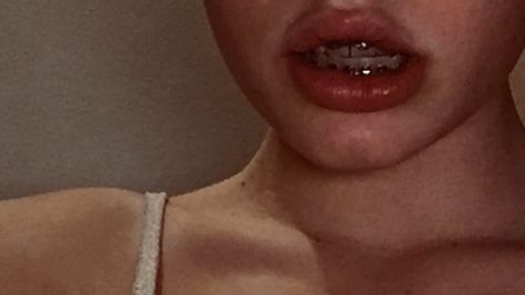 #aesthetic #lips #braces #teeth Teeth Aesthetic Braces, Brace Aesthetics, Teeth Braces Aesthetic, Bunny Teeth Aesthetic, Lips With Braces, Crooked Teeth Aesthetic, Braces Aesthetic Girl, Orthodontics Aesthetic, Aesthetic Braces