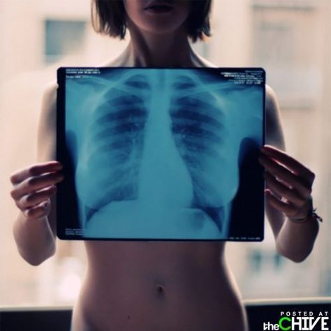 XRays are so cool.... Human Ribs, Skelita Calaveras, Xray Art, X-ray Images, Best Portraits, Gcse Art, Radiology, Art Model, X Ray