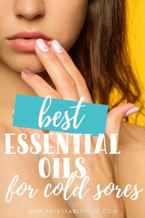 How To Use Essential Oils For Cold Sores Essential Oil For Fever Blister On Lip, Doterra Cold Sore Remedy, Home Remedy For Fever Blister, Remedies For Cold Sores Lips, Essential Oils For Cold Sores On Lip, Essential Oils For Fever Blister, Home Remedy For Cold Sore On Lip, Essential Oil For Cold Sore On Lip, Lip Sore Remedy