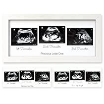 Mom To Be Gifts, Sonogram Picture Frame, Baby Sonogram, Baby Ultrasound, Alpine White, Mom To Be, Ultrasound, Baby Nursery, Picture Frame