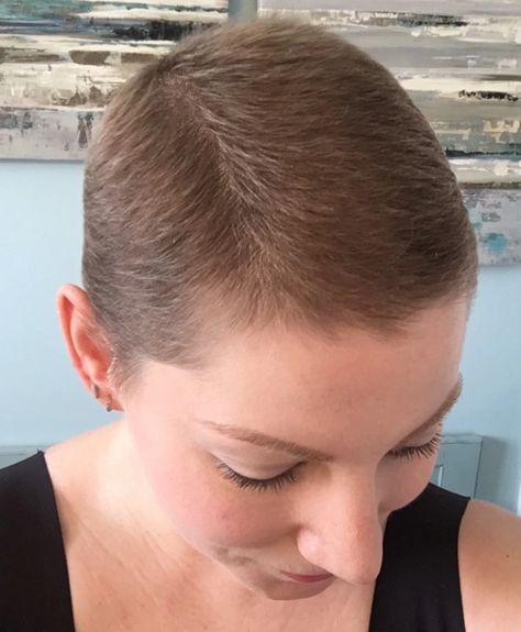 Tips for post-chemo hair growth Short Hair Styles After Chemo, Chemo Loss Of Hair, Hair Extensions After Chemo, Growing Out Chemo Hair, Hair Growth After Chemo Pictures, Hair After Chemo Regrowing, After Chemo Hairstyles, Chemo Hair Growing Out, Chemo Curls Hairstyles