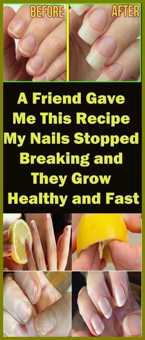 A Friend Gave Me This Recipe And My Nails Stopped Breaking And They Grow Healthy And Fast Nail Growth Tips Faster, Nail Growth Tips, Grow Nails Faster, Nail Hardener, Broken Nails, Nail Repair, How To Grow Nails, Nail Growth, Strong Nails