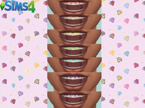 Sims 4 Cc Braces Patreon, Sims 4 Braces Mod, Sims4 Braces Cc, Sims 4 Colored Braces, The Sims 4 Cc Braces, Sims Braces Cc, Sims4 Braces, Braces Cc Sims 4, Sims 4 Braces Teeth