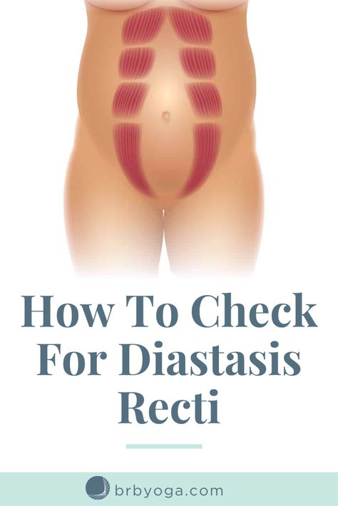 Diasis Recti, Diastasis Recti Before After, Diastis Recti Exercises, Diastis Recti, Pregnancy Core Workout, Abdominal Rectus Diastasis Recti, Diastasis Recti Repair, Postpartum Yoga, Healing Diastasis Recti