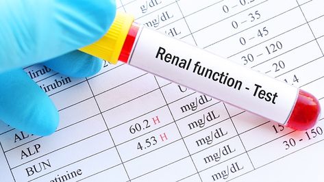 Analysis of glomerular filtration rates from more than 3000 US persons highlighted the broad variance that can occur between estimated and directly measured kidney values. Glomerular Filtration, Creatinine Levels, Cohort Study, Uric Acid, University Of Mississippi, Internal Medicine, Health System, Divergent, Medical Center