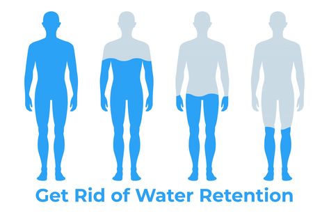 How to Get Rid Of Water Retention Fluid Retention Remedies, Water Retention Causes, Sweet Sweat Waist Trimmer, Water Retention Remedies, Lose Water Weight, Swollen Ankles, Retaining Water, Sweet Sweat, Swollen Legs