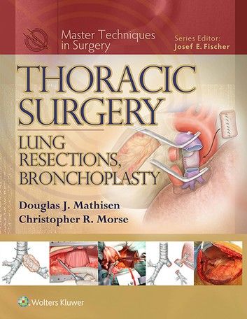 Thoracic Surgery, General Surgery, Medicine Book, Breast Surgery, Disease Prevention, Science Books, Radiology, Health Science, Post It Notes