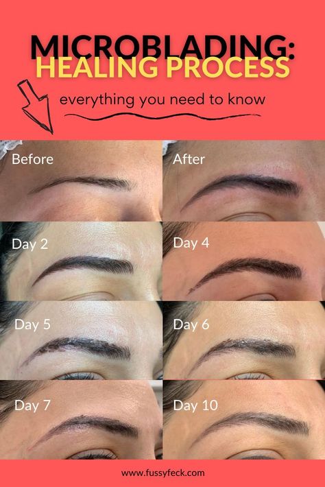 There is a lot to think about when it comes to Microblading your eyebrows, afterall, it is practically a semi-permanent tatoo on your face! Where and how do you find a great technician? What preparation and aftercare is required? How to make sure your freshly pigmented eyebrows stay on your face in the first 7 days!? Everything you need to know is in this guide.   #microblading #microbladingeyebrows #microbladingresults #microbladinghealingprocess #microbladingbeforeandafter Microblading Healing Process, Regrow Eyebrows, Eyebrow Images, What Is Microblading, Mircoblading Eyebrows, Brow Care, Lash Salon, Permanent Makeup Eyebrows, Permanent Eyebrows