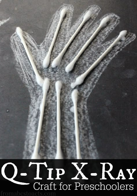 Introduce your preschooler to the bones of the body as part of an All About Me or My Body theme with this fun x-ray craft made out of Q-Tips! Infants Crafts, Bones Of The Body, Body Preschool, Homework Ideas, Craft Preschool, Body Bones, All About Me Preschool, Body Craft, Preschool Projects