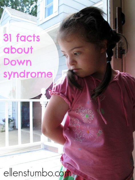 31 Facts About Down Syndrome. I love this site, Ellen Stumbo writes with beauty, grace, and honesty. Down Sydrome, Therapeutic Recreation, Special Needs Kids, Important Facts, Human Experience, Life Skills, Special Education, Facts About, Super Powers