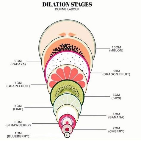 Creative way to learn about dilation stages during labour. @pregnancy.advice . The birth of your child is a special and unique experience.… Duvet Day, Pharmacy School, Water Birth, Pregnancy Advice, Medical Facts, Obstetrics And Gynaecology, Medical Anatomy, Medical Art, Easy Learning