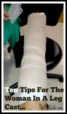 Ten Tips For The Woman In A Leg Cast Sponge Bath After Surgery, Broken Ankle Cast, Broken Fibula, Ankle Cast, Ankle Surgery Recovery, Broken Ankle Recovery, Ankle Recovery, Injured Leg, Ankle Fracture