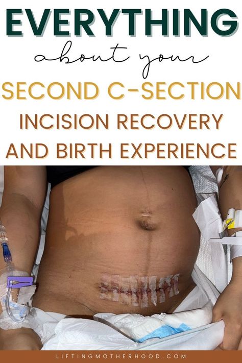 Post Partum Recovery C Section, Second C Section, C Section Hairstyles, C Section Post Partum Workout, C Section Pictures, C Section Post Partum Essentials, C Section Post Partum, C-section, Post C Section Recovery