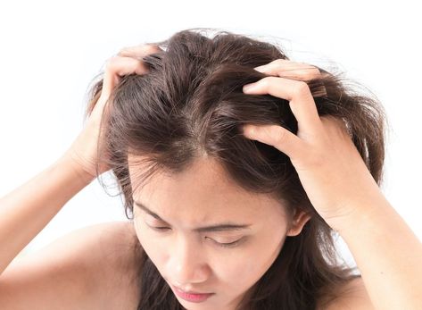 **6 Reasons Why Your Scalp is Itchy and What to Do About It** In the winter time, it is not uncommon for your skin to itch. The dry weather and, depending on where you live, the cold conditions can make your skin dry, itchy and uncomfortable. In this article, we are going to explore the most common reasons that you may be experiencing an itchy scalp and what you can do about it. Losing Hair Women, Bad Wigs, Itchy Scalp, Hair Growth Tips, Hair Regrowth, Hair Restoration, Hair Transplant, Beauty Treatments, Hair Mask