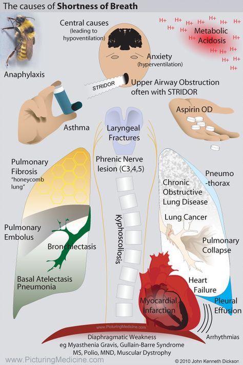 Shortness Of Breath Causes, Medic School, Student Paramedic, Emt Study, Nursing Labs, Basal Ganglia, Guillain Barre, Ulnar Nerve, Pulmonology