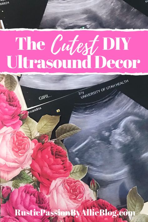 This is the cutest idea to display your ultrasound pictures. Whether you are looking for ultrasound announcement ideas, baby shower decor ideas, or just a fun DIY nursery decoration this is it. It's a great way to have a keepsake from your pregnancy you can display in your home. #nurserydecor #pregnancyannouncement #ultrasoundpictures #babyannouncement #diynurserydecor Ultrasound Room Decor, Ideas For Ultrasound Pictures Display, What To Do With Ultrasound Pictures, Ultra Sound Picture Ideas, Ultrasound Keepsake Ideas, Sonogram Picture Ideas Display, Ultrasound Pictures Display, Baby Ultrasound Pictures Ideas, Sonogram Picture Ideas