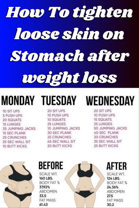 Workout For Loose Skin, Workout To Tighten Loose Belly Skin, Workouts To Tighten Loose Skin, Sagging Stomach Exercise, Exercises For Loose Skin, Skin Tightening Workout, Tone Loose Belly Skin, Exercise For Loose Belly Skin, Tighten Skin On Stomach