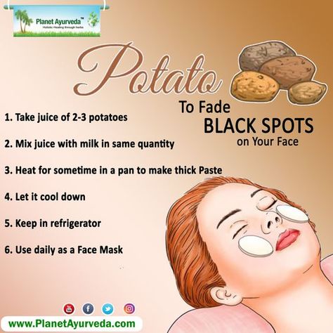 Potato to fade black spots on your skin Potato Skin Care Dark Spots, How To Get Rid Of Pigmentation, Potato Face Pack For Glowing Skin, Potato For Skin, Face Remedies, Potato Face, Benefits Of Potatoes, Massage Routine, Dark Spots Remedies