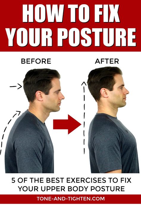 Posture Correction Exercises, Posture Fix, Fix Your Posture, Forward Head Posture, Shoulder Knots, Neck Exercises, Improve Your Posture, Posture Exercises, Bad Posture