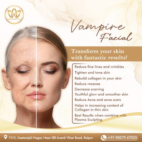 #MayaAestheticClinic #ENTSpecialist
.
.
#Vampire #Vampirefacial #acne #acnescars #acnescar #facial #facials #VampireFacialTreatment #SkinCare #wrinkles #BeautyTreatment #skintreatment #skinclinicinraipur #skincareNearMe #international #Drmanyathakur #AestheticClinics #look #redcarpet #actors #selflove #models #youthfulglow #raipur Maya Aesthetic, Hair Poster Design, Skin Notes, Esthetician Inspiration, Dental Advertising, Hair Poster, Vampire Facial, Tone Skin, Skin Aesthetics