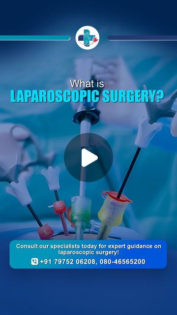 Looking for safe and effective surgical care? Laparoscopic surgery offers quicker recovery, minimal pain, and smaller incisions—ensuring you get back to life faster! 🏥

✨ Our specialties include:
✔ Gallbladder and hernia treatments
✔ Advanced minimally invasive techniques
✔ Personalized care by expert surgeons

📞 Consult our specialists today for the best laparoscopic solutions! Laparoscopic Surgery Recovery, Laparoscopic Surgery, Back To Life, Get Back, Surgery