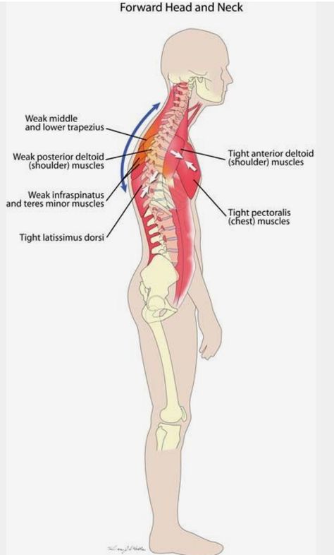 Punkty Spustowe, Psoas Release, Forward Head Posture, Latissimus Dorsi, Muscle Imbalance, Upper Back Pain, Muscle Anatomy, Chest Muscles, Back Muscles