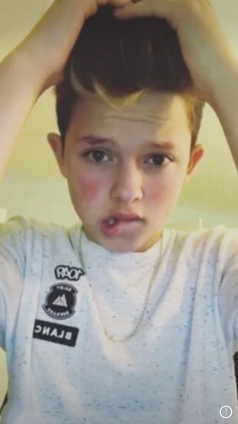 Cringe Jacob Sartorius, Lip Bite Meme, Jacob Sartorius Snapchat, Bite Lip, Biting Lip, Jacob Sartorius, You're Amazing, Funny Profile, I Have A Crush