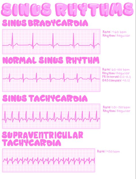 Ekg Mnemonics, Ekg Notes, Easy Ekg Interpretation Cheat Sheets, Ekg Rhythms Cheat Sheets, Ekg Interpretation Made Easy Cheat Sheets, Ekg Technician, Cardiac Rhythms Cheat Sheets, Ekg Technician Aesthetic, Cardiac Dysrhythmias Cheat Sheets