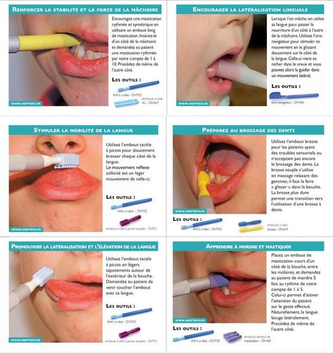 Orofacial Myofunctional Therapy, Oral Motor Activities, Myofunctional Therapy, Speech Therapy Tools, Sensory Therapy, Language Therapy Activities, Speech Therapy Games, Oral Motor, Pediatric Occupational Therapy