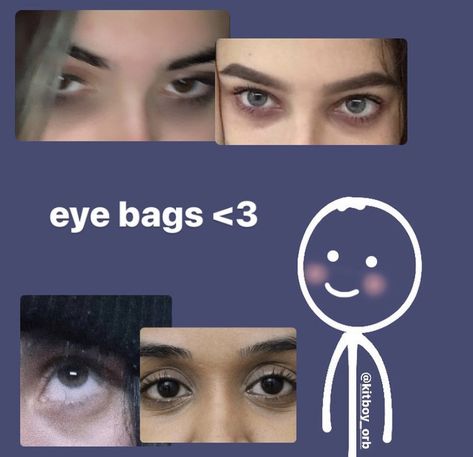 Eye Bags Aesthetic, Healthy Body Image, Celebrating Diversity, Positive Body Image, Loving Yourself, Facebook Memes, Bags Aesthetic, Eye Bags, Coping Mechanisms