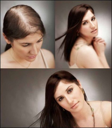 Eat away your hair loss problems! @ http://www.stylecraze.com/articles/eat-away-your-hair-loss-problems/ Natural Beauty Care, Hair Regrowth, Latest Hairstyles, Stylish Hair, Grow Hair, Leave In, Fall Hair, Hair Hacks, Hair Trends