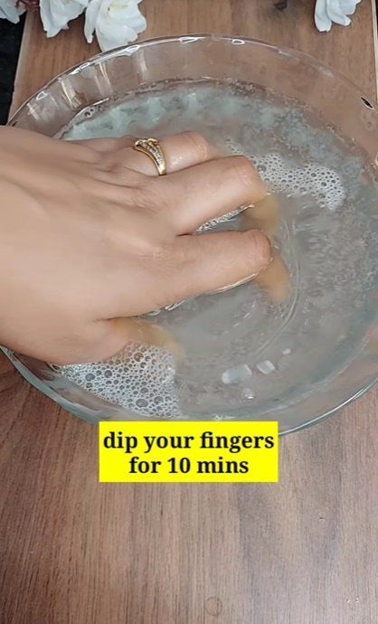 How To Get Nails White, How To Clean Yellow Nails, How To Make Nails White Natural, How To Make Nails White, How To Get White Nails, How To Clean Nails At Home, White Toe Nails Ideas, How To Whiten Nails, Gold Sparkly Nails