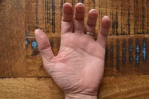 The Real Reasons Your Fingers Turn Black When Playing Guitar Gray Streaks, Learn Singing, Guitar Exercises, Types Of Guitar, Playing The Guitar, Cheap Guitars, Guitar Practice, Learn To Play Guitar, Play Guitar