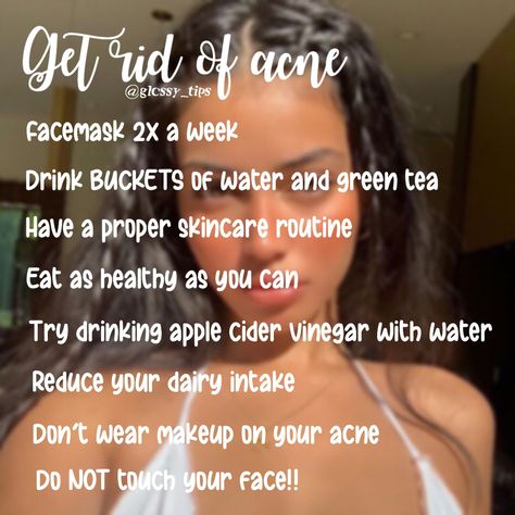 Teenage Acne Skincare Routine, Skincare Tips For Teens, Chest Acne Remedies, Gus Sha, Skincare The Ordinary, Girl With Acne, Skincare Model, Glow Up Skin, Organization Skincare