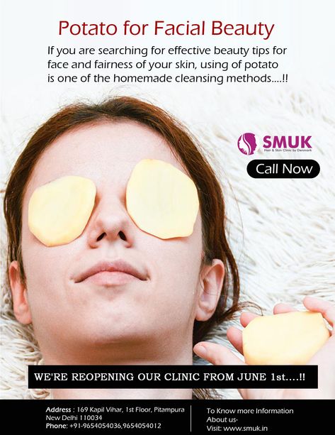 Potato for Facial Beauty: If you are searching for effective beauty tips for face and fairness of your skin, using of potato is one of the homemade cleansing methods. Apply the juice of raw potatoes on the black rings under the eyes or slice a raw potato and rub it on the face, especially the black circles. It removes darkness from under the eyes. Thus potato improves the beauty of your eyes as well as the face. 👉Get to know more about SMUK on - http://www.smuk.in Cleansing Methods, Raw Potato, Beauty Tips For Face, Skin Clinic, Care Tips, Black Rings, Makeup Skincare, Skin Care Tips, Your Eyes