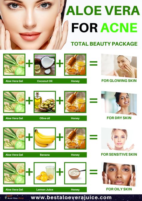 Aloe Vera for Acne Total beauty package. The antibacterial properties of #aloe_vera_gel are very effective in treating acne and reducing the redness caused by it. It prevents bacteria from infecting #acne wounds and accelerates the process of healing. Its anti-fungal properties are useful in treating inflammation like boils and cysts on the #skin. #Aloe_Vera_for_Acne #AloeVera_gel #beauty_package Alovera Gel For Face Benefits, Aloe Vera For Oily Skin, Aloevera Skincare For Acne, Aloe Vera For Acne Before And After, Does Aloe Vera Help Acne, How To Apply Aloe Vera To Face, Aleo Vera For Face Glow, Aloe Vera For Eyelashes, Aloe Vera For Skin Skincare