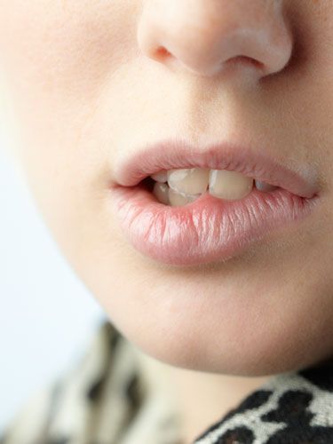 Keep your lips kissable Remedies For Dry Mouth, Health Pictures, Dry Mouth, Teeth Health, Lip Exfoliator, Gum Care, Oral Health Care, Health Articles, Dental Health