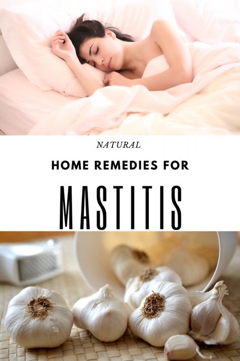 Natural At Home Remedies For Mastitis - keeper of our home Mastitis Remedies, Cold Sores Remedies, Health And Fitness Magazine, Natural Cold Remedies, Healthy Diet Tips, Natural Cough Remedies, Fitness Advice, Good Health Tips, Natural Health Remedies