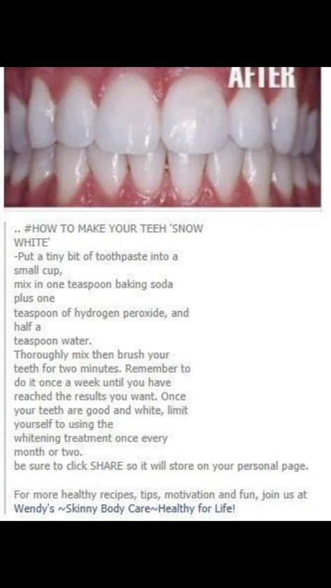 White Teeth Tips, Hydrogen Peroxide Teeth, Baking Soda Hydrogen Peroxide, Teeth Whitening Diy, Homeopathic Remedies, Hydrogen Peroxide, White Teeth, Teeth Whitening, Live Lokai Bracelet