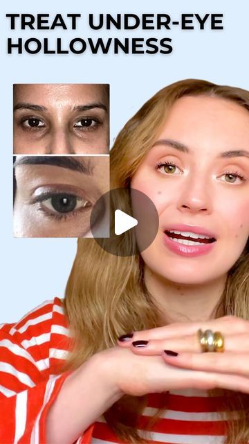 Hollow Eyes Exercise, Under Eye Hollows Exercise, Under Eye Hollows Remedies, Hollow Eyes Makeup, Hollow Under Eyes, Under Eye Hollows, Hollow Eyes, Sunken Eyes, Drainage Massage