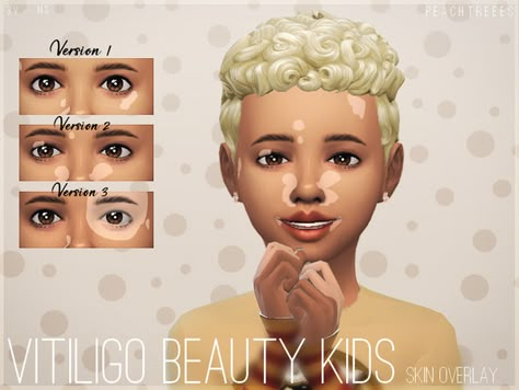 peachtreees' Vitiligo Beauty Skin Overlay KIDS N3 Sims 4 Cc Skin Details, Sims 4 Skin, The Sims 4 Kids, Skin Overlay, Mods Sims 4, Sims 4 Cc Eyes, The Sims 4 Skin, Makeup Cc, Skin Details