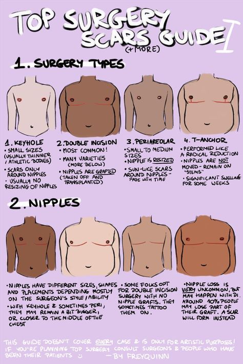 n. frey @ commissions open • B.L.M on Twitter: "TOP SURGERY scars(+more) guide ✨ i have seen very few guides on drawing chests that have undergone top surgery & the few i've seen were very flawed, so now that i've recovered from my own surgery i decided to draw my own! this may have more parts if i remember more stuff!… https://t.co/LA0pAo1PfE" Top Surgery Scars, Top Surgery, Trans Art, Trans Boys, Losing 40 Pounds, Tweek Y Craig, Trans Pride, Happier Life, Lose 40 Pounds