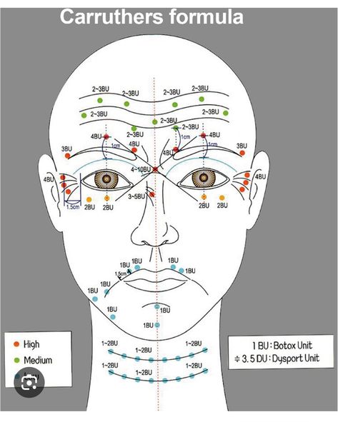 Botox Injection Sites, Dermal Fillers Lips, Facial Injections, Injection Sites, Botox Injection, Botox Before And After, Botulinum Toxin, Cosmetic Injectables, Facial Fillers