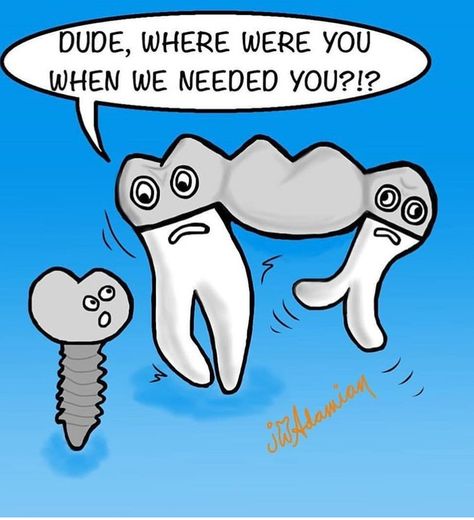 Before dental implants there were bridges... if you're tired of getting food stuck underneath, or you think your bridge may need a replacement, come in for a free dental implant consultation! Orthodontic Humor, Dental Awareness, Dentist Quotes, Dentist Jokes, Free Dental Implants, Dentistry Humor, Radiology Humor, Dental Quotes, Dental World