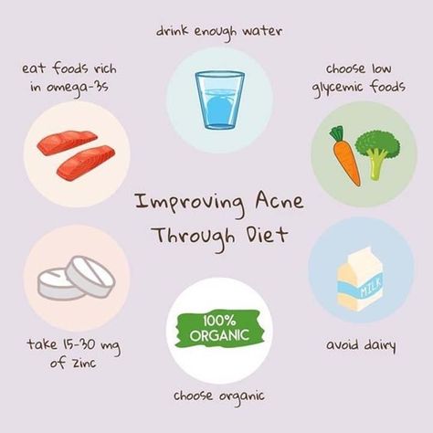 Acne Diet Plan, Anti Acne Diet, Hormonal Acne Diet, Food For Acne, Acne Causing Foods, Back Acne Remedies, Clear Skin Diet, Acne Diet, Foods For Healthy Skin