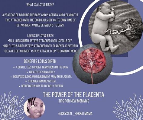 Krystal Jenkins on Instagram: "Good morning lovely people! Baby it’s cold outside ❄️🌨️ Here is part 2 of the power of the placenta. Yesterday we discussed the Benefits of encapsulation the placenta, what the placenta is and the purpose it serves in utero. Today we are discussing lotus birth and it’s various levels. As always be sure to consult your midwife, doula and or OB concerning benefits and possible risk. Be sure to make an informed decision on what is best for you and baby. Whatever you Lotus Birth, Delayed Cord Clamping, Birth Worker, Placenta Encapsulation, Baby Delivery, Healthy Pregnancy Tips, In Utero, Pregnancy Labor, Baby Life Hacks