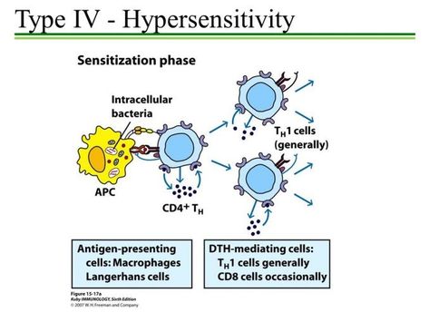 Hypersensitivity Type IV: Mechanism and Clinical Manifestation – Microbe Online Hypersensitivity Types, Langerhans Cell, Hypersensitivity Reactions, Biology Lessons, Biology Notes, Medical Anatomy, Medical Laboratory, Chronic Inflammation, Biochemistry