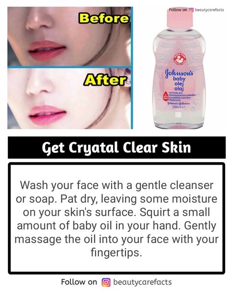 How To Use Baby Oil For Skin, Johnson Baby Oil Uses Skin Care, Baby Oil Uses Skin Face, Baby Oil For Face Skin Care, Baby Oil Hacks, Baby Oil Uses, Crystal Clear Skin, Facial Routine Skincare, Beauty Treatments Skin Care