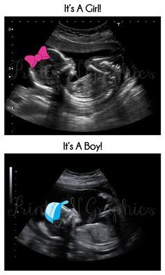 A Customized Sonogram Baby Sonogram, Sonogram Pictures, Creative Gender Reveals, Unique Pregnancy Announcement, Gender Reveal Announcement, Baby Ultrasound, Ultrasound Pictures, Ideas For Baby Shower, Gender Reveal Ideas